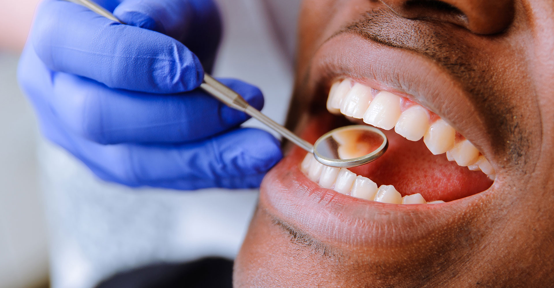 Dental Travma Hakkında Hasta İçin Bilgi