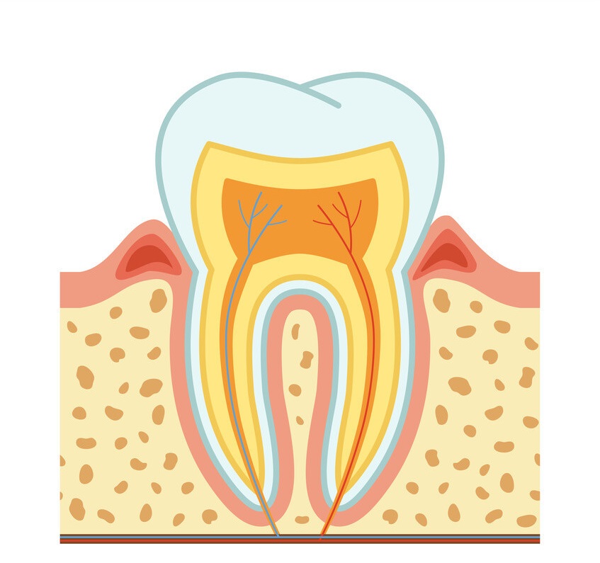 Kronik Periodontal Absenin Tedavisi