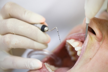 Periodontal Hastalıkta Prognoz ve Tedavi Planı