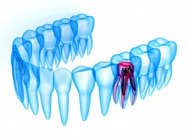 Destekleyici Periodontal Tedavi